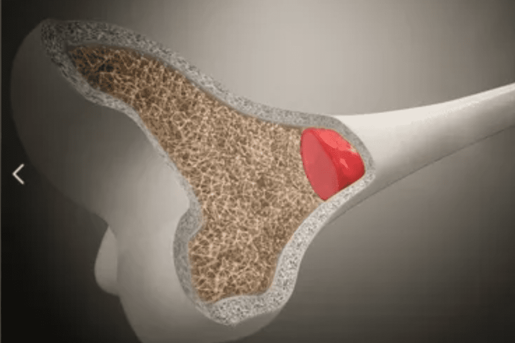 soreness after donation