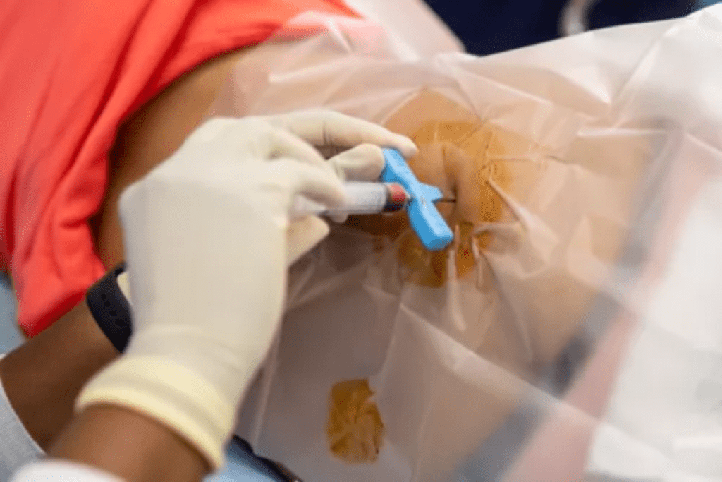 Bone Marrow Transplant: Procedure, Steps & What to Expect