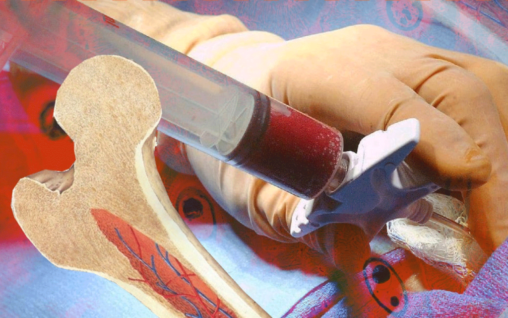 Understanding Stem Cell DNA and Bone Marrow Transplants