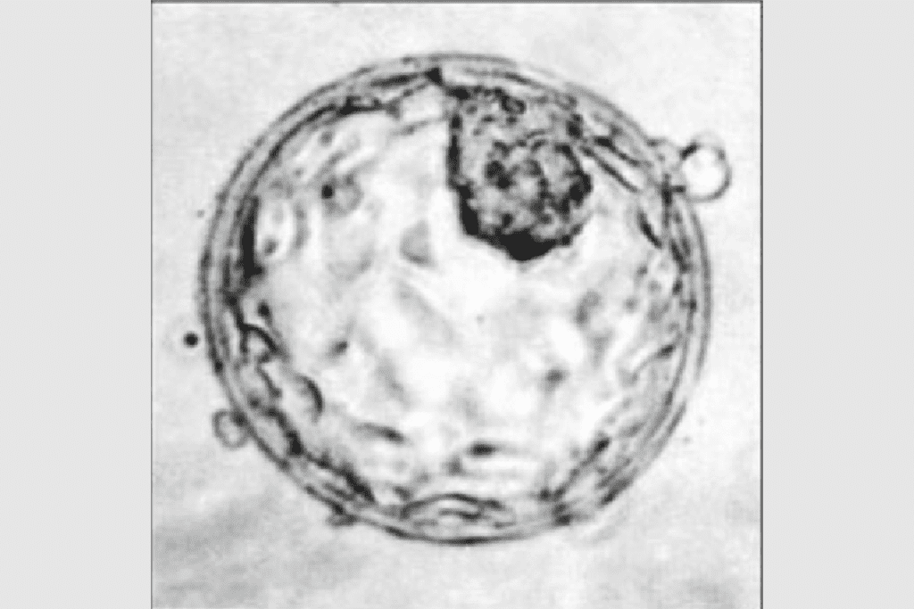 Inner Cell Mass of Blastocyst: Powerful Stem Cell Source