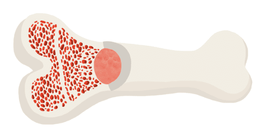 Understanding Adult Multipotent Stromal Cells: Key Properties and Roles 3 Understanding Adult Multipotent Stromal Cells: Key Properties and Roles