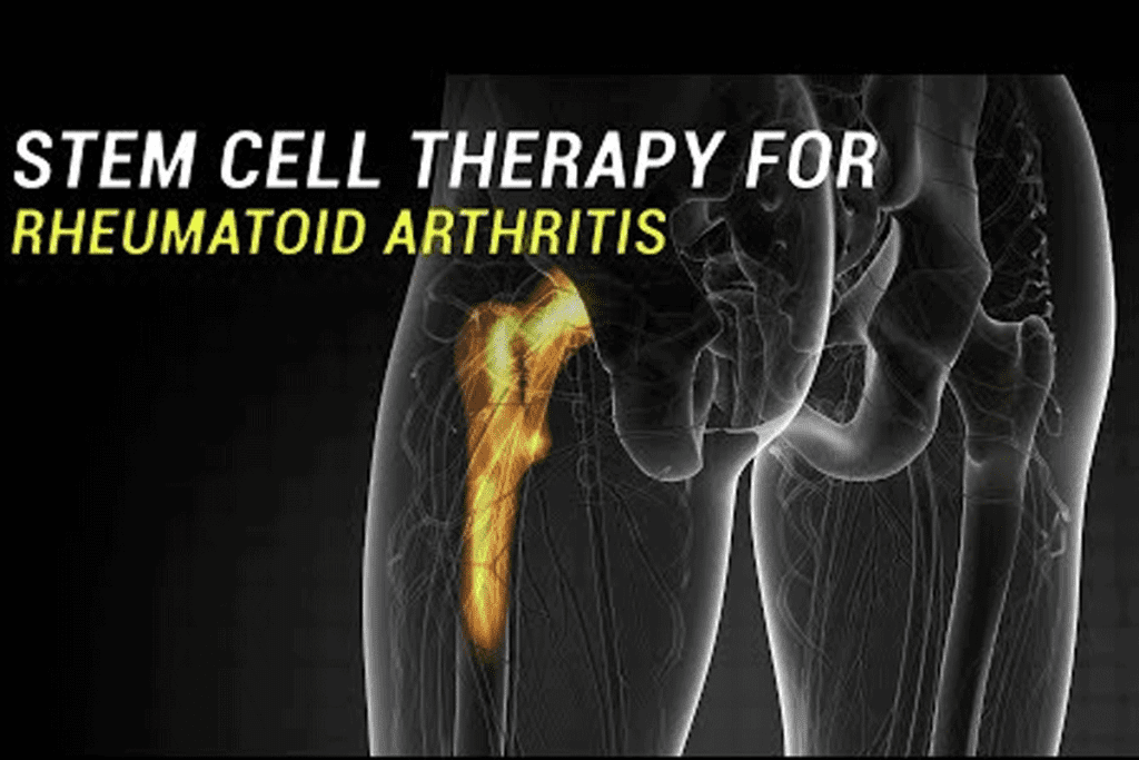   7 Amazing Ways Stem Cells Are Good for Arthritis