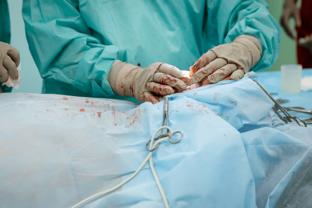 Is It Painful to Donate Bone Marrow? Facts and Insights 2 Is It Painful to Donate Bone Marrow? Facts and Insights