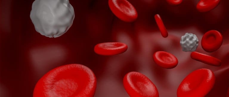 Myelodysplastic syndromes