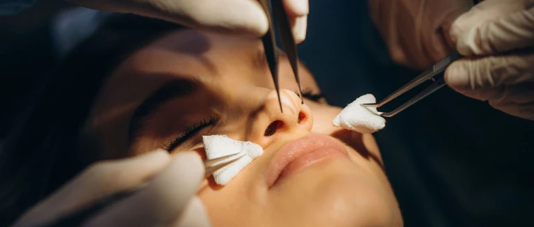 Nose Surgery -Rhinoplasty-: 5 Comfort Tips 2 Nose Surgery -Rhinoplasty-