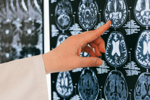 Stem Cell Transplant: Understanding the Procedure and Process