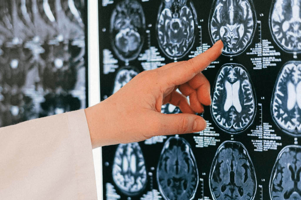 Turmeric Brain Benefits: Boosting Stem Cells and Cognitive Health