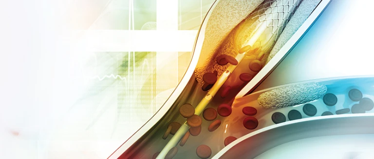 Cardiac Patients LIV Hospital