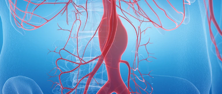 Scalpel-Free Treatment for Brain Aneurysms 1 Scalpel-Free Treatment