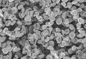 Can a Body Reject a Bone Marrow Transplant: Understanding Stem Cell Transplant Cost and Risks