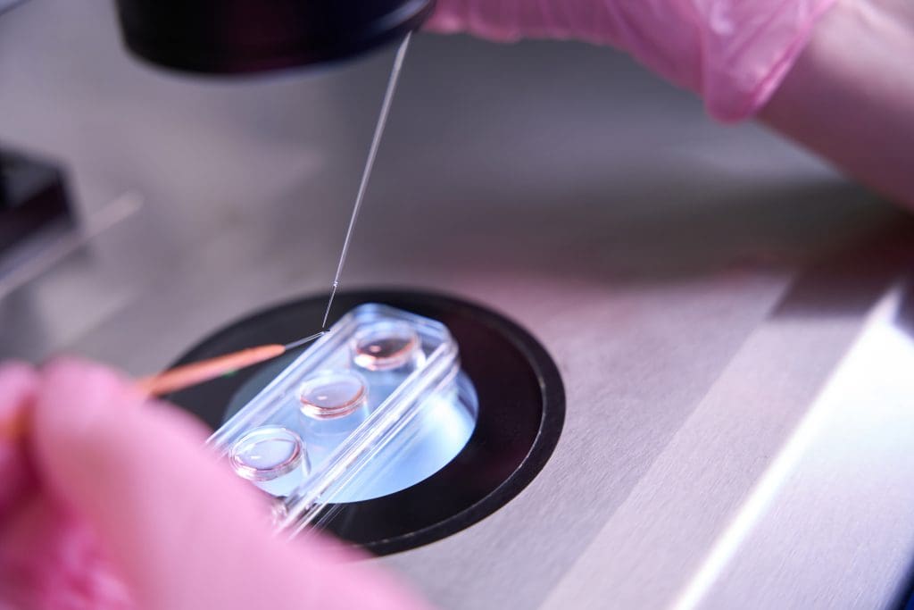 What is an Example of Induced Pluripotent Stem Cells? 1 Example of Induced Pluripotent Stem Cells