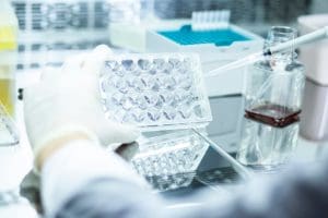 Risks of Allogeneic Stem Cell Transplant