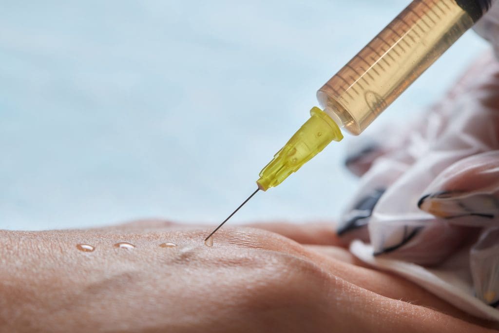 Is Stem Cell Therapy Painful? Understanding Stem Cell Therapy Side Effects 1 Is Stem Cell Therapy Painful? Understanding Stem Cell Therapy Side Effects