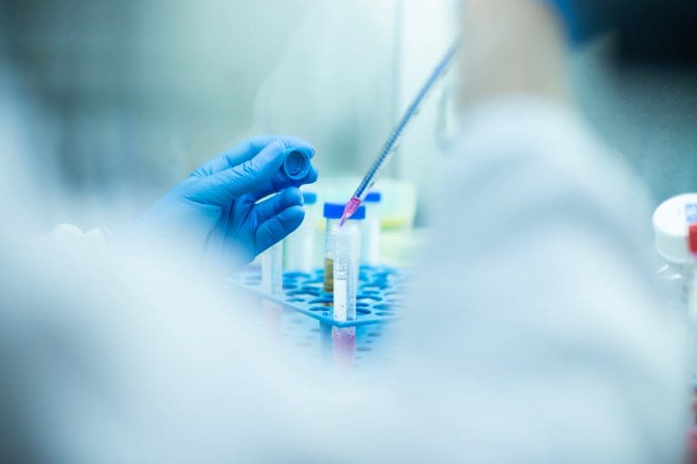 Can You Use Stem Cells From Your Own Body? Understanding Autologous Stem Cell Transplant