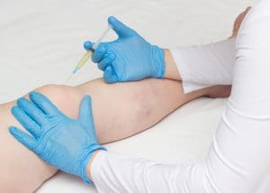 What Is Needed for Stem Cell Therapy? Understanding the Stem Cell Transplant Procedure