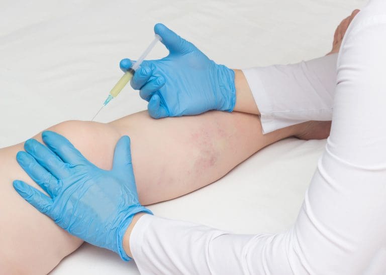 What Is Needed for Stem Cell Therapy? Understanding the Stem Cell Transplant Procedure