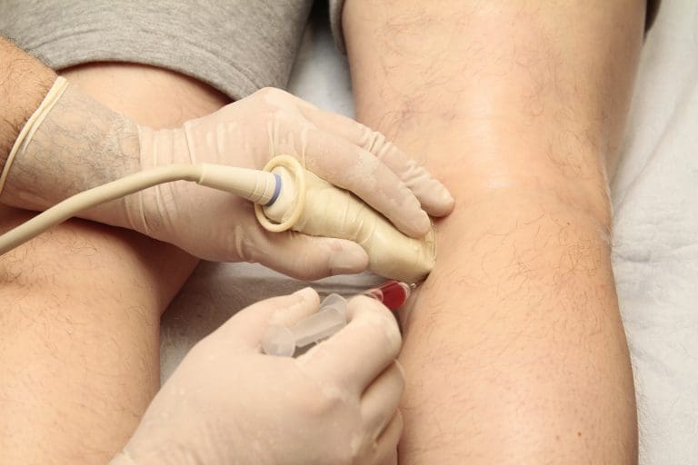 How Long Do Stem Cell Injections Last?