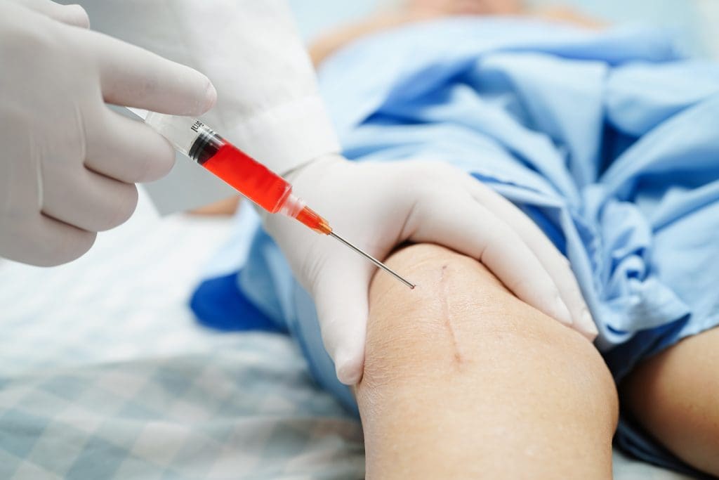 How Long Do Stem Cell Injections Last? 1 Stem Cell Injections