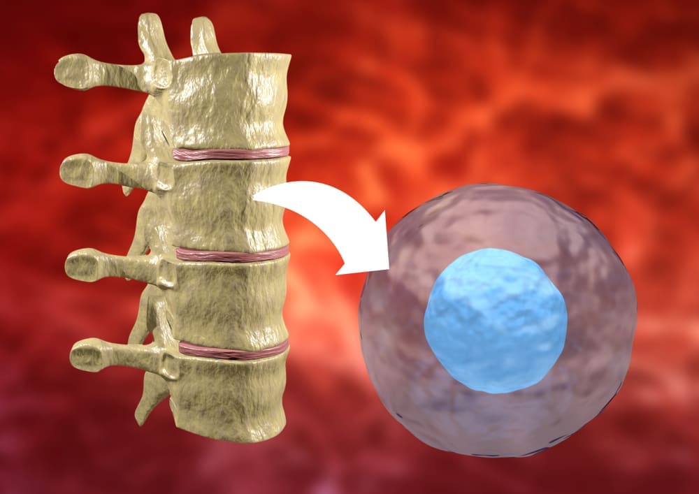 Stem cell therapy in orthopedics