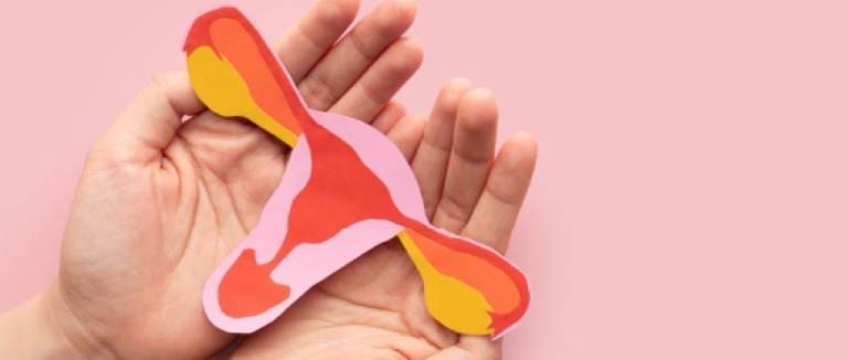 Pelvic Congestion Syndrome Treatment 1 Pelvic Congestion Syndrome