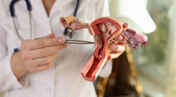 Myoma Surgery: Comfortable Recovery Guide