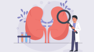 Kidney Transplantation: 5 Powerful Tips