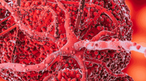 Acute Myeloid Leukemia: 5 Powerful Facts