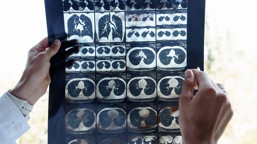 How Many CT Scans Are Safe Per Year? 3 how many ct scans are safe per year
