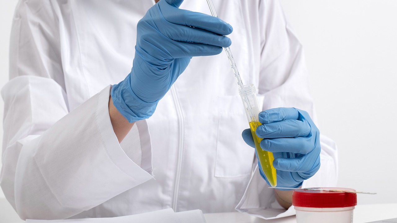 Uroflow Test: 100% Painless & Quick Guide 4 Uroflow Test