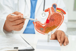 Key Difference Between Gastric Bypass And Sleeve Surgery