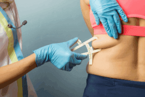 Guide To Sleeve Gastroplasty (Esg) For Weight Loss