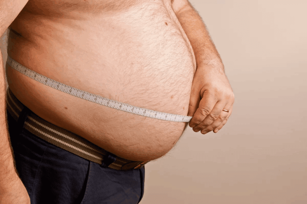 Guide To Endoscopic Gastroplasty (Esg)