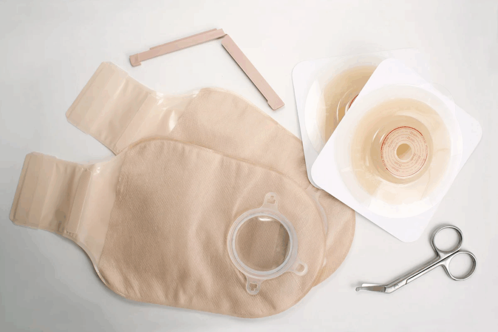 Types And Management Of Surgical Diversion