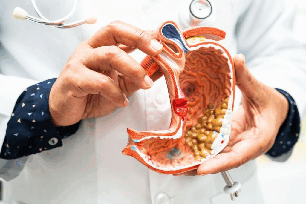 Guidelines For Calorie Intake 1 Year After Gastric Bypass