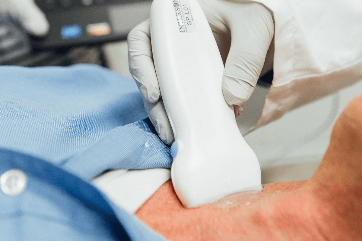 FET Ultrasound: Your Complete Guide to Success