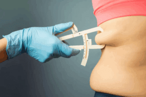5 Benefits Of Duodenal Switch Weight Loss Surgery