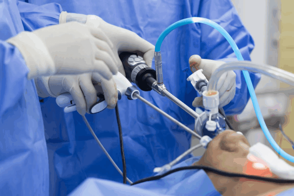 Complete Guide To Biliopancreatic Diversion Duodenal Switch Surgery 1 Complete Guide To Biliopancreatic Diversion Duodenal Switch Surgery