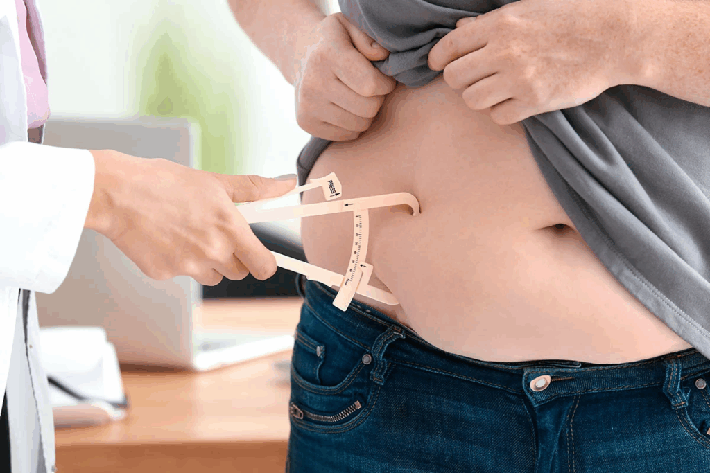 Defining What Is Dumping Syndrome After Bariatric Surgery