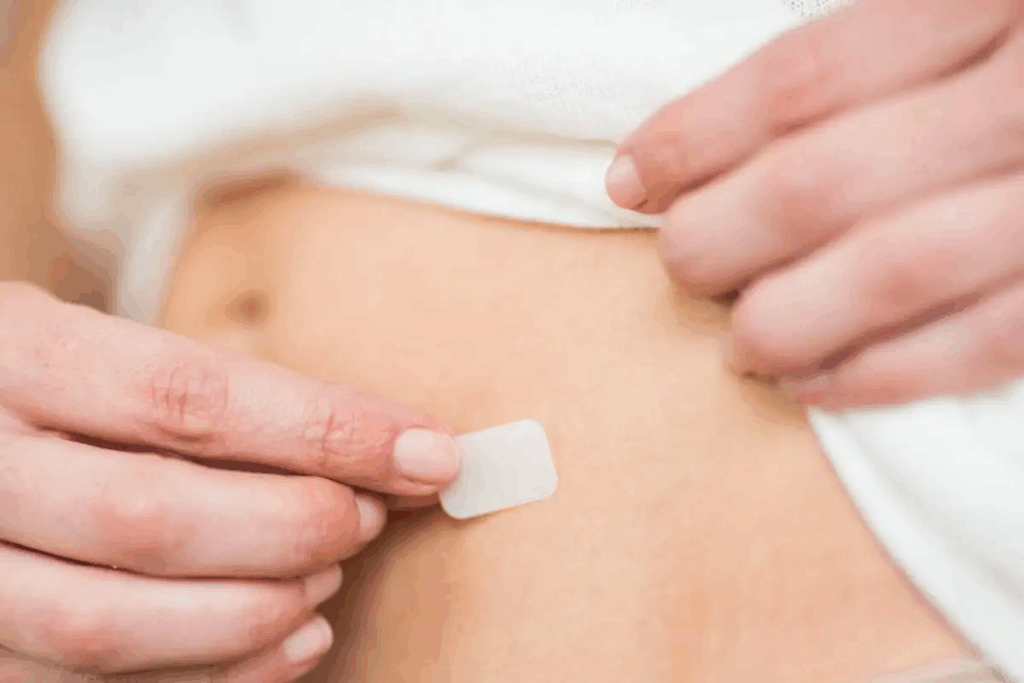 Estrogen Patch and IVF: Your Ultimate Guide