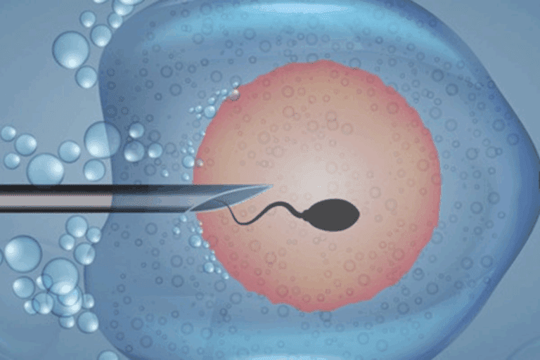 10 Essential Steps On How To Prep For Ivf And Maximize Outcomes