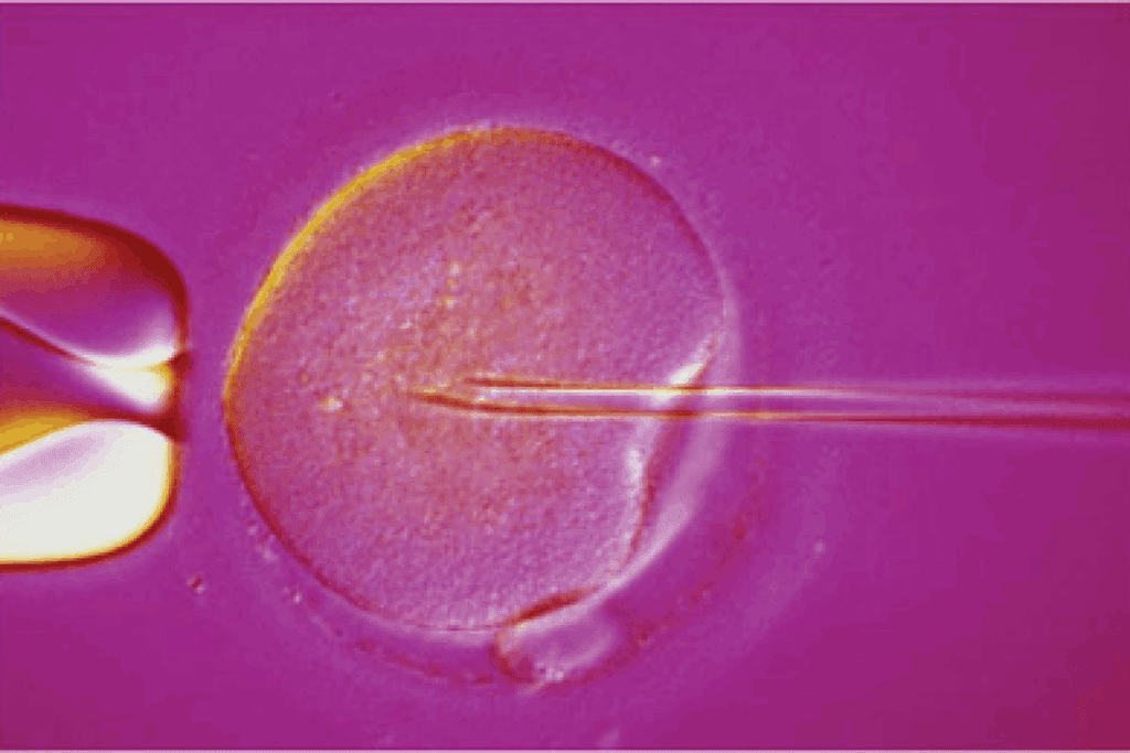 Essential prep for egg retrieval Checklist and Instructions