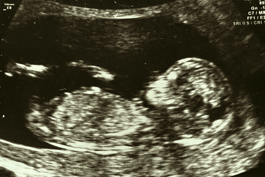 The Target: what is a good estradiol level for egg retrieval?