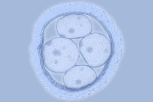 Azoospermia: The condition of without sperm in Ejaculate