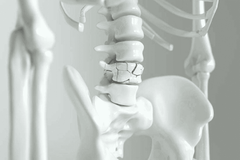 Four Major Joint Categories