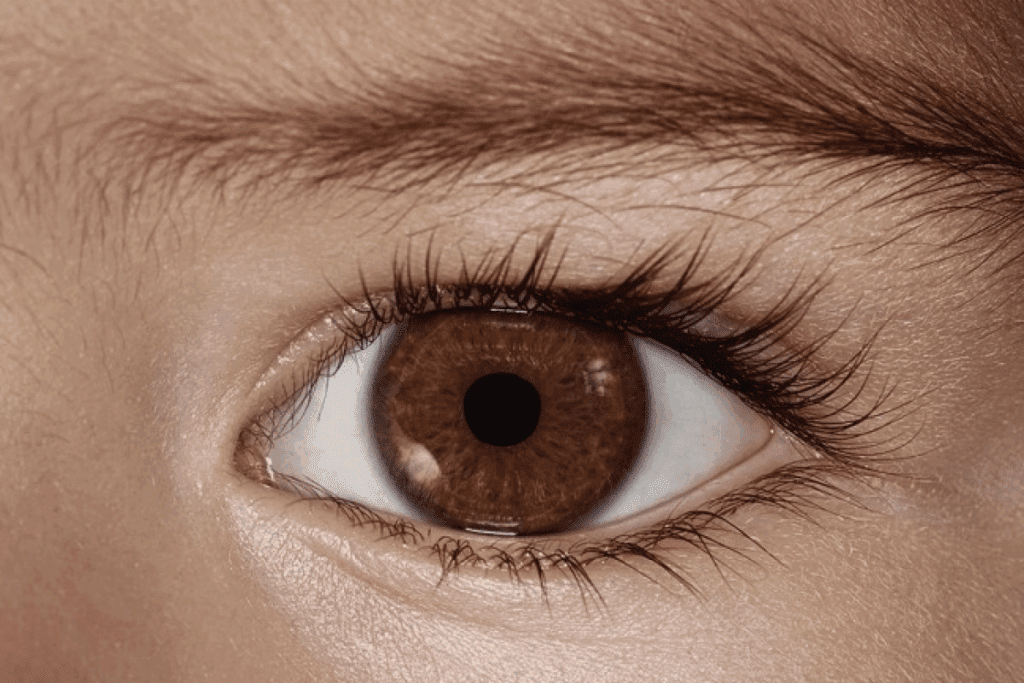Congenital Risk: retinoblastoma causes and Birth Presence