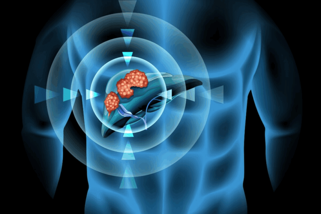 Hepatoblastoma Rarity: Critical Facts on Low Incidence Numbers