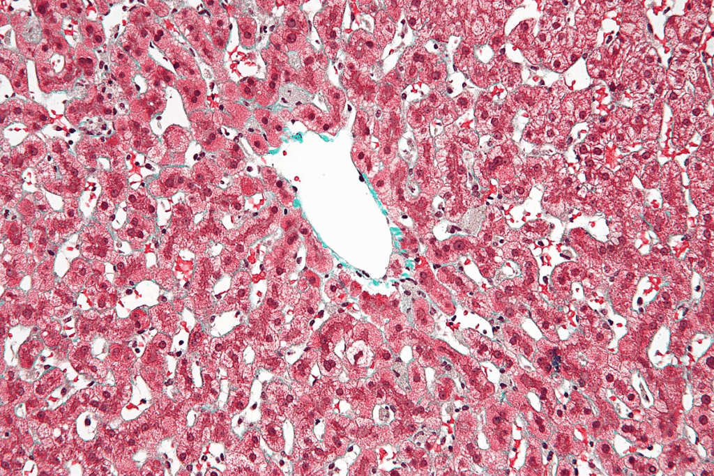 Liver Regeneration After Removal: Amazing Facts on This Powerful Organ