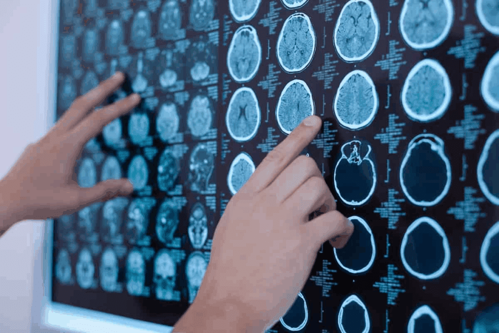 Childhood Brain Tumors Symptoms