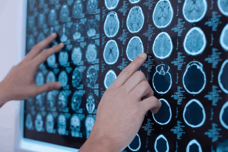 Childhood Brain Tumors Symptoms