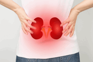 Why Does Kidney Stone Cause Blood in Urine: Explained Clearly - Liv